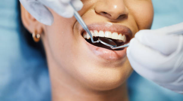 Best Knocked-Out Tooth Emergency  in Tustin, CA